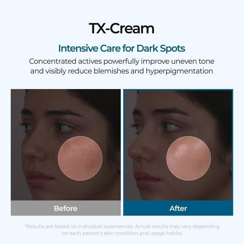 🔥𝙇𝙞𝙢𝙞𝙩𝙚𝙙-𝙏𝙞𝙢𝙚 𝙊𝙛𝙛𝙚𝙧 |TX Cream 50ml｜Nano-sized Tranexaminc Acid for Dark Spots & Hyperpigmentation
