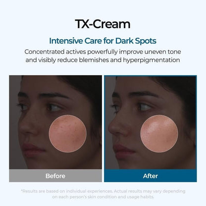 🔥𝙇𝙞𝙢𝙞𝙩𝙚𝙙-𝙏𝙞𝙢𝙚 𝙊𝙛𝙛𝙚𝙧 |TX Cream 50ml｜Nano-sized Tranexaminc Acid for Dark Spots & Hyperpigmentation